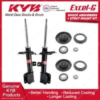 Front KYB Shock Absorbers Strut Mount Kit for Peugeot 307 9HZ NFU RFN RHY 01-08